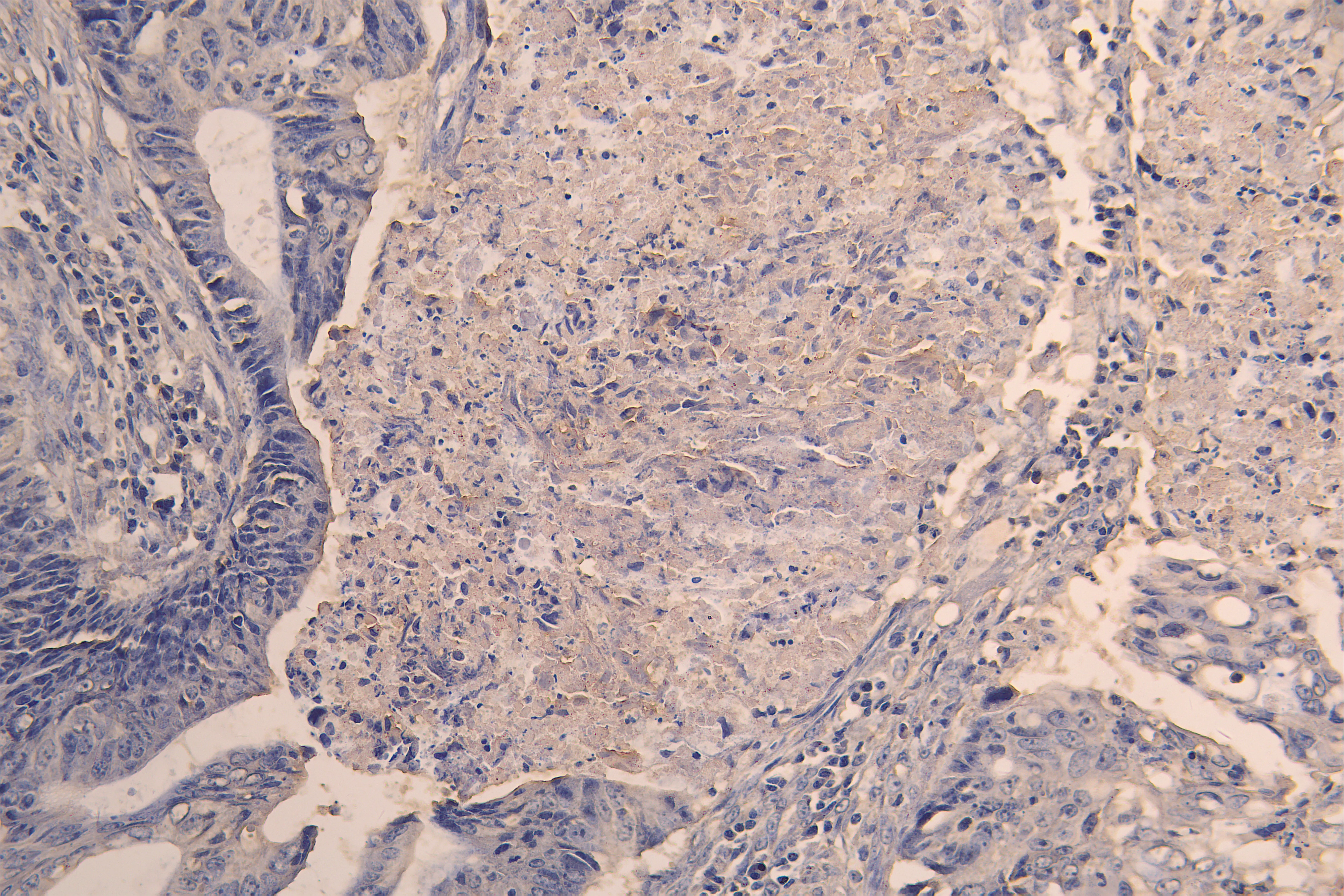 ACVR2B Recombinant Monoclonal Antibody - image 2