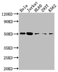 CASP2 Recombinant Monoclonal Antibody - image 1