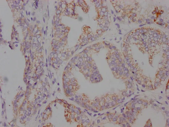 AMACR Monoclonal Antibody - image 1