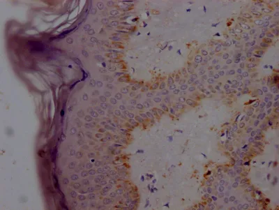 SNCA Recombinant Monoclonal Antibody - image 1