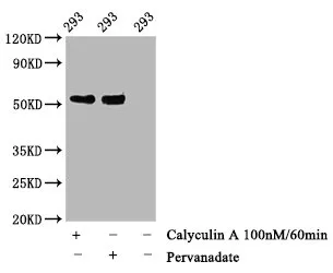 Phospho-TP53 (T55) Recombinant Monoclonal Antibody - image 1