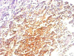 B2M Monoclonal Antibody - image 1