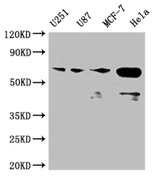 STK3 Recombinant Monoclonal Antibody - image 1
