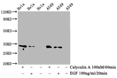 Phospho-CDK1/CDK2/CDK3 (T14) Recombinant Monoclonal Antibody - image 1