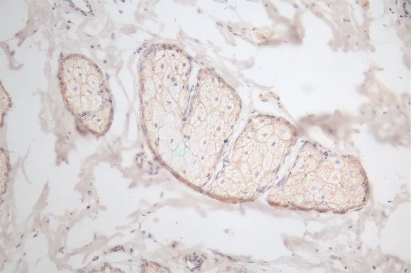 EGF Recombinant Monoclonal Antibody - image 1