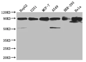 HSP90AB1 Recombinant Monoclonal Antibody - image 1