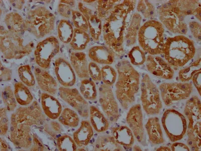 GPX4 Recombinant Monoclonal Antibody - image 1