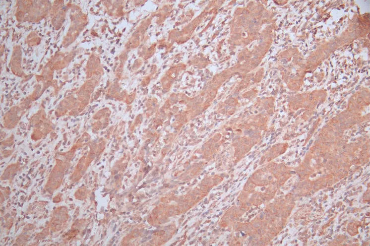 EDAR Recombinant Monoclonal Antibody - image 1