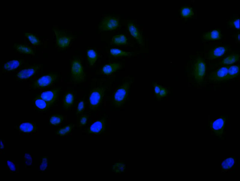 PITX3 Recombinant Monoclonal Antibody - image 1