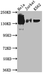 STAG2 Recombinant Monoclonal Antibody - image 1