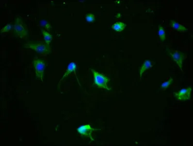 Phospho-MAPT (S324) Recombinant Monoclonal Antibody - image 1