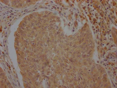 ATF6 Antibody - image 1