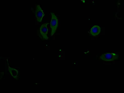 Phospho-PERK (T981) Monoclonal Antibody - image 1