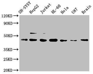 CCR9 Recombinant Monoclonal Antibody - image 1