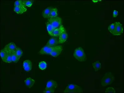 CCR9 Recombinant Monoclonal Antibody - image 2