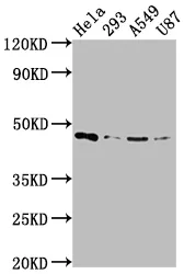 MAP2K1 Recombinant Monoclonal Antibody - image 1