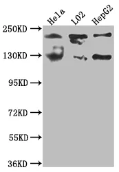 MGEA5 Recombinant Monoclonal Antibody - image 1