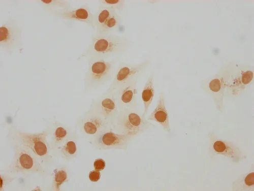 Mono-methyl-H2AFZ (K7) Antibody - image 1