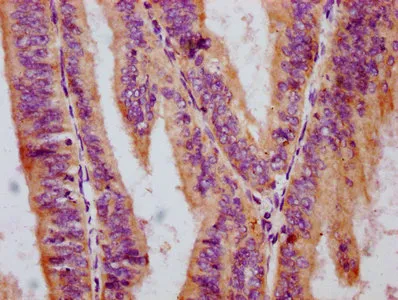 Phospho-RAF1 (S259) Recombinant Monoclonal Antibody - image 3