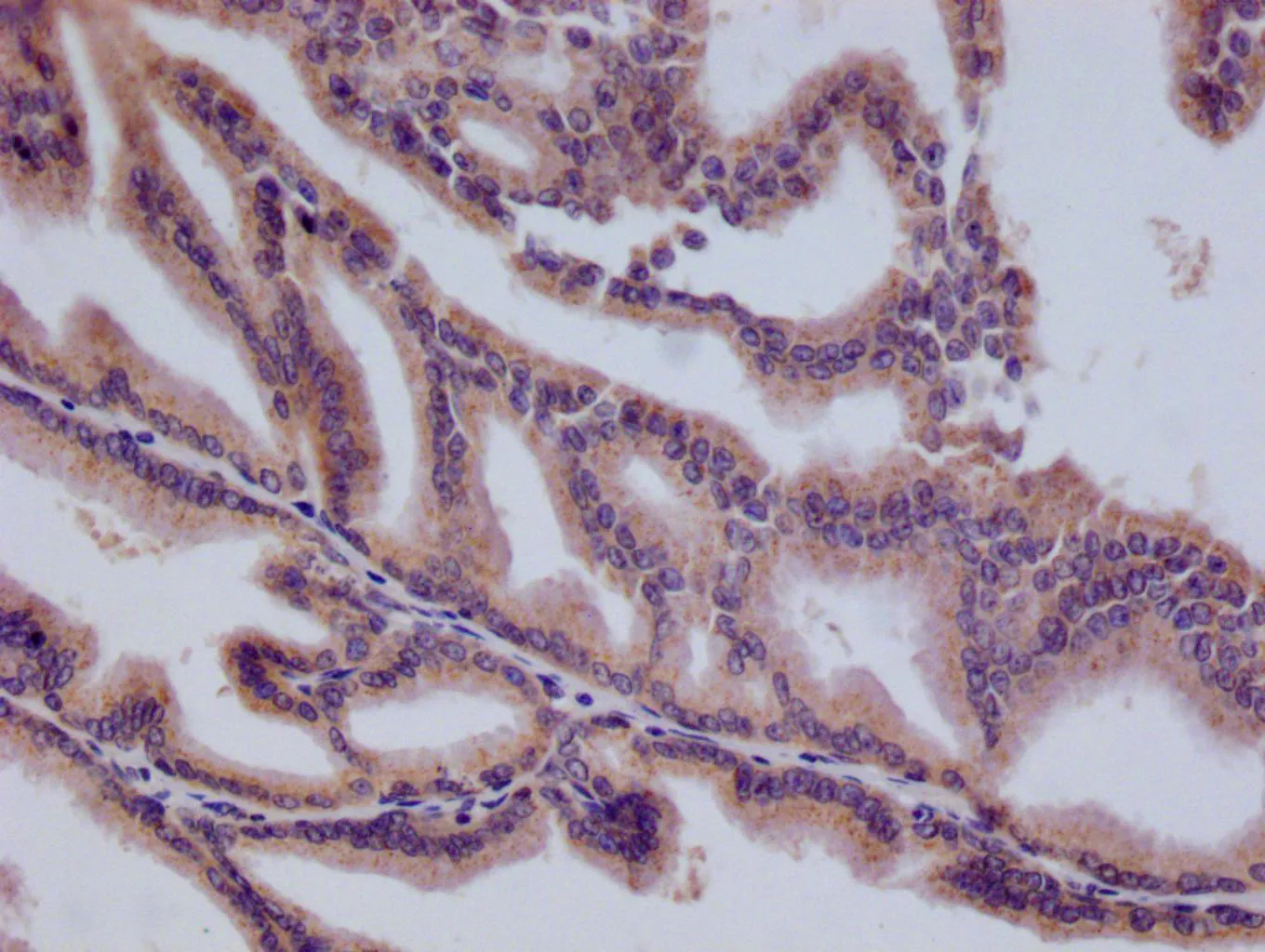 HMGCL Recombinant Monoclonal Antibody - image 3