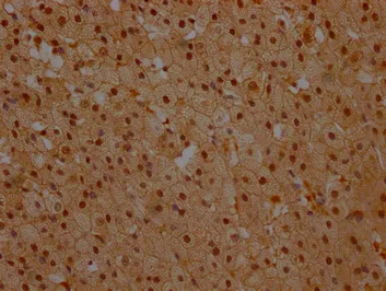NFKBIA Antibody - image 3