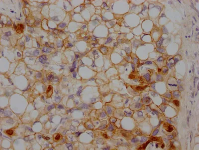 CTNNB1 Recombinant Monoclonal Antibody - image 3