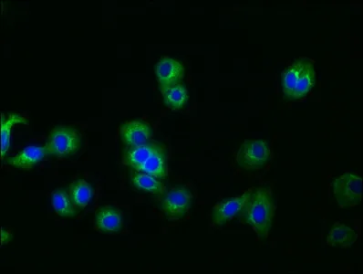 GPC3 Recombinant Monoclonal Antibody - image 3