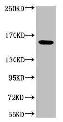 ERBB2 Monoclonal Antibody - image 1
