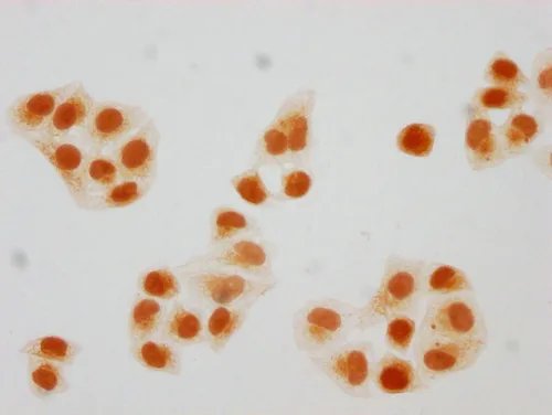 2-hydroxyisobutyryl-HIST1H2BC (K108) Antibody - image 1