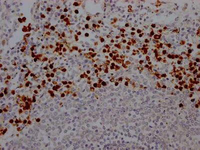 MPO Recombinant Monoclonal Antibody - image 1