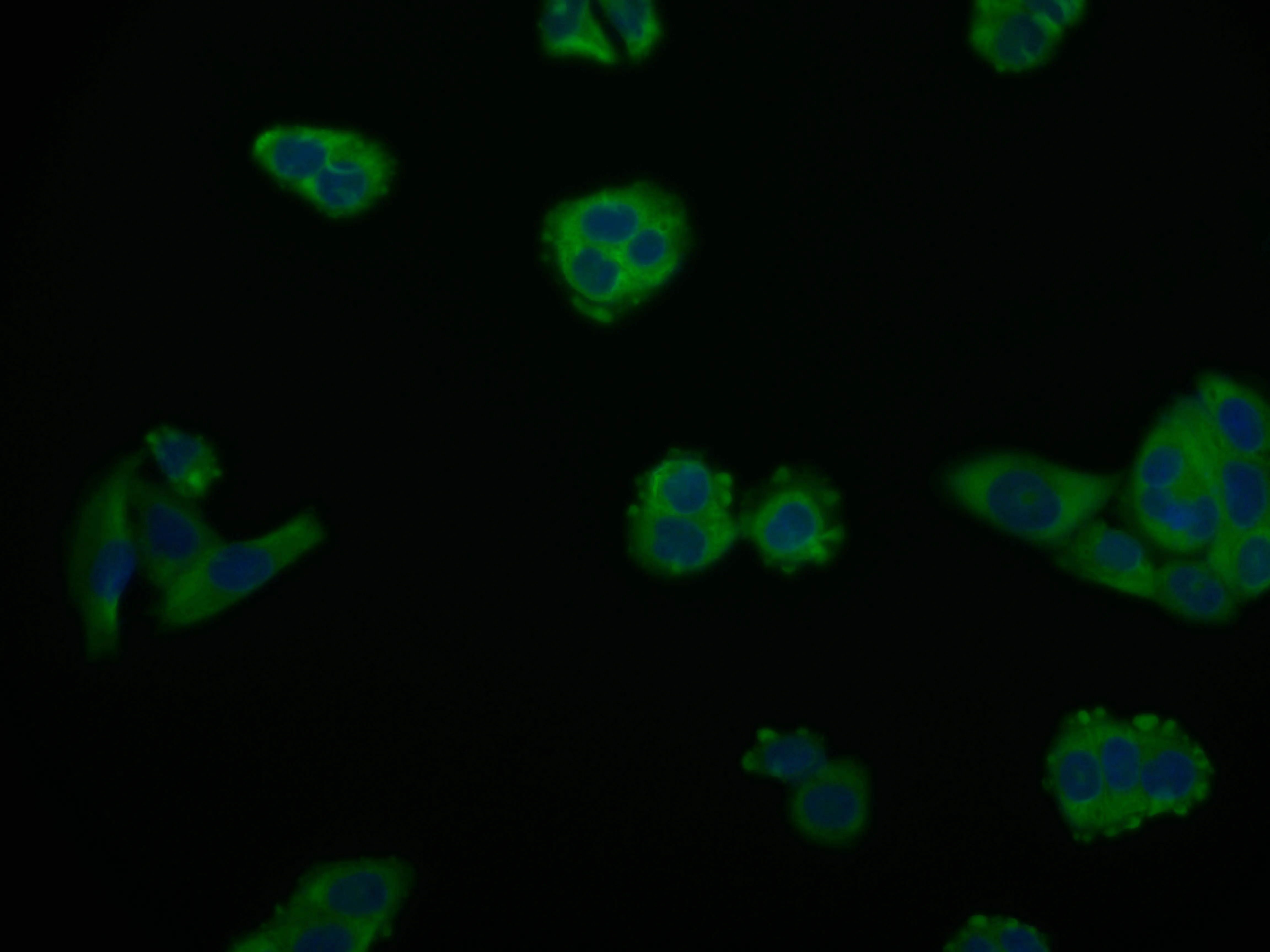 ARG2 Recombinant Monoclonal Antibody - image 2