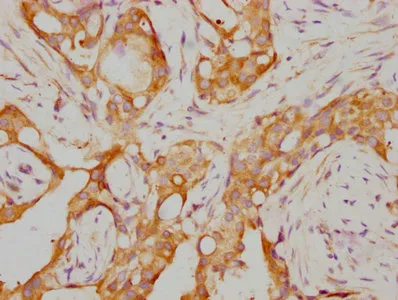 RARA Recombinant Monoclonal Antibody - image 1
