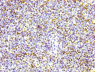 Phospho-Histone H1.4 (T17) Recombinant Monoclonal Antibody - image 1