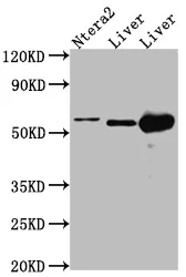 ALDH2 Recombinant Monoclonal Antibody - image 1