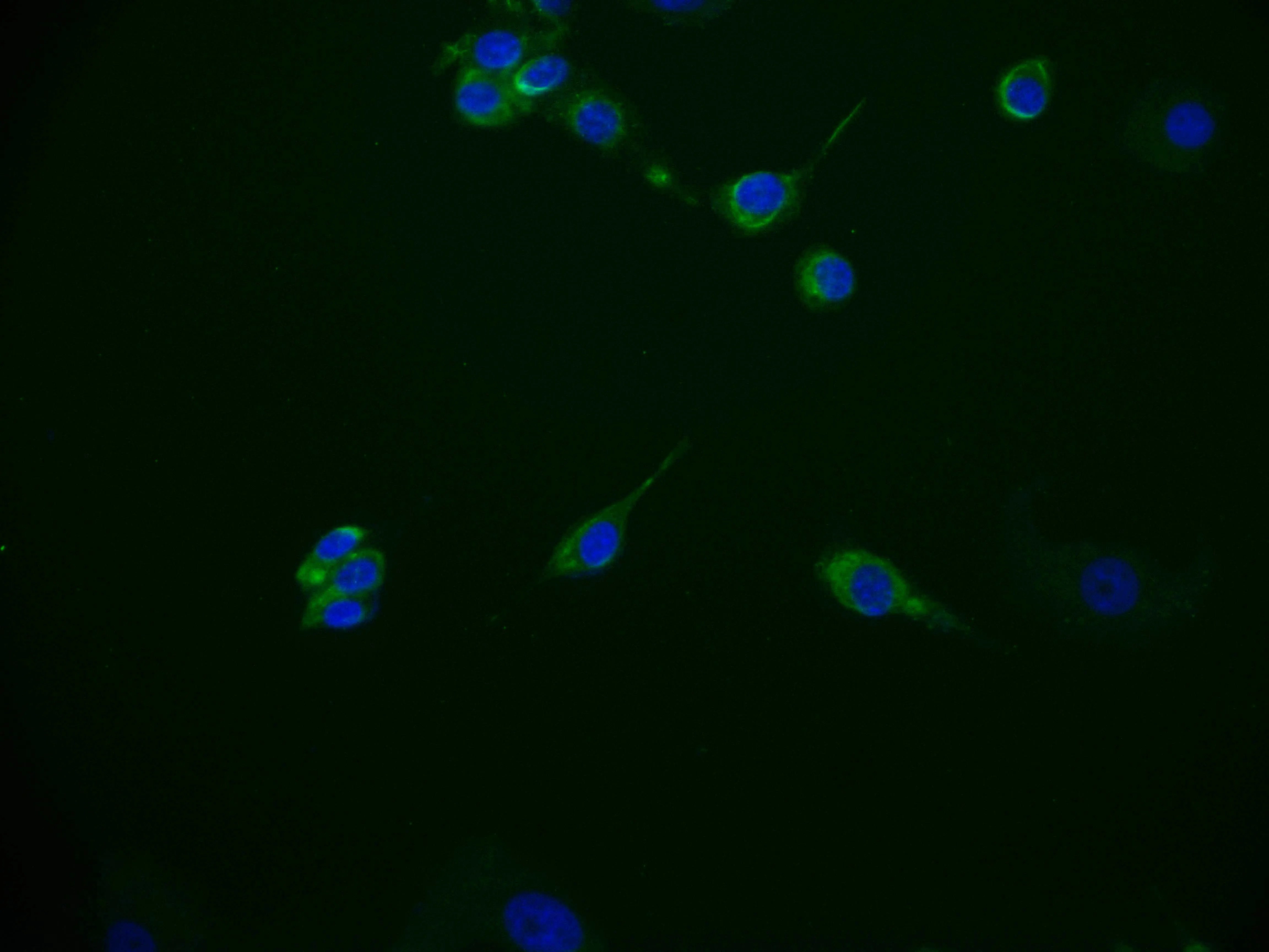 ITGA6 Recombinant Monoclonal Antibody - image 1