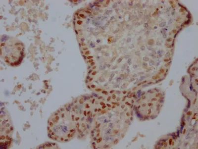 DNMT1 Recombinant Monoclonal Antibody - image 1