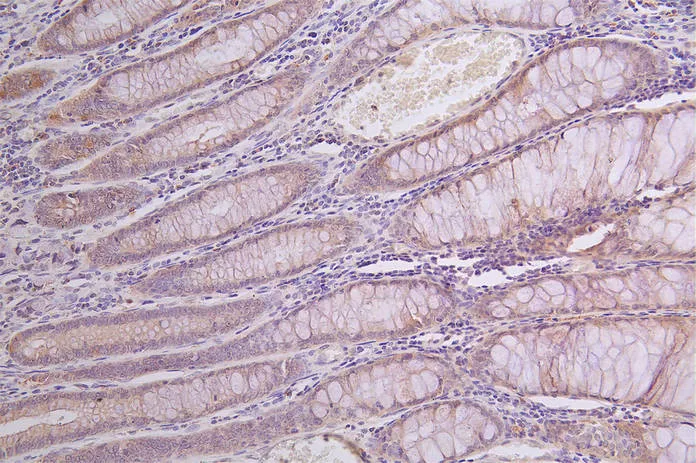 GLA Recombinant Monoclonal Antibody - image 1