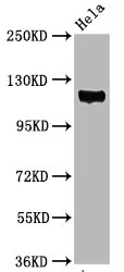 Phospho-PTK2 (Y397) Recombinant Monoclonal Antibody - image 1