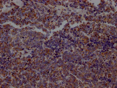 ACO2 Recombinant Monoclonal Antibody - image 1