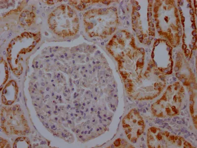 ACO2 Recombinant Monoclonal Antibody - image 2