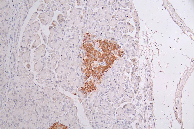 KRT10 Recombinant Monoclonal Antibody - image 1