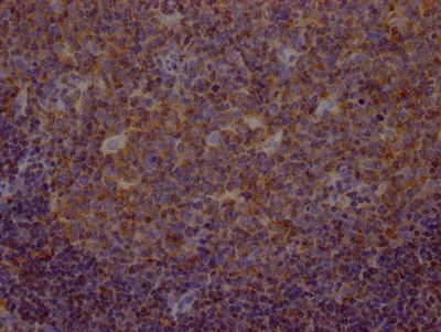 METAP2 Recombinant Monoclonal Antibody - image 1