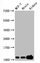 Tri-methyl-Histone H4 (K20) Recombinant Monoclonal Antibody - image 1