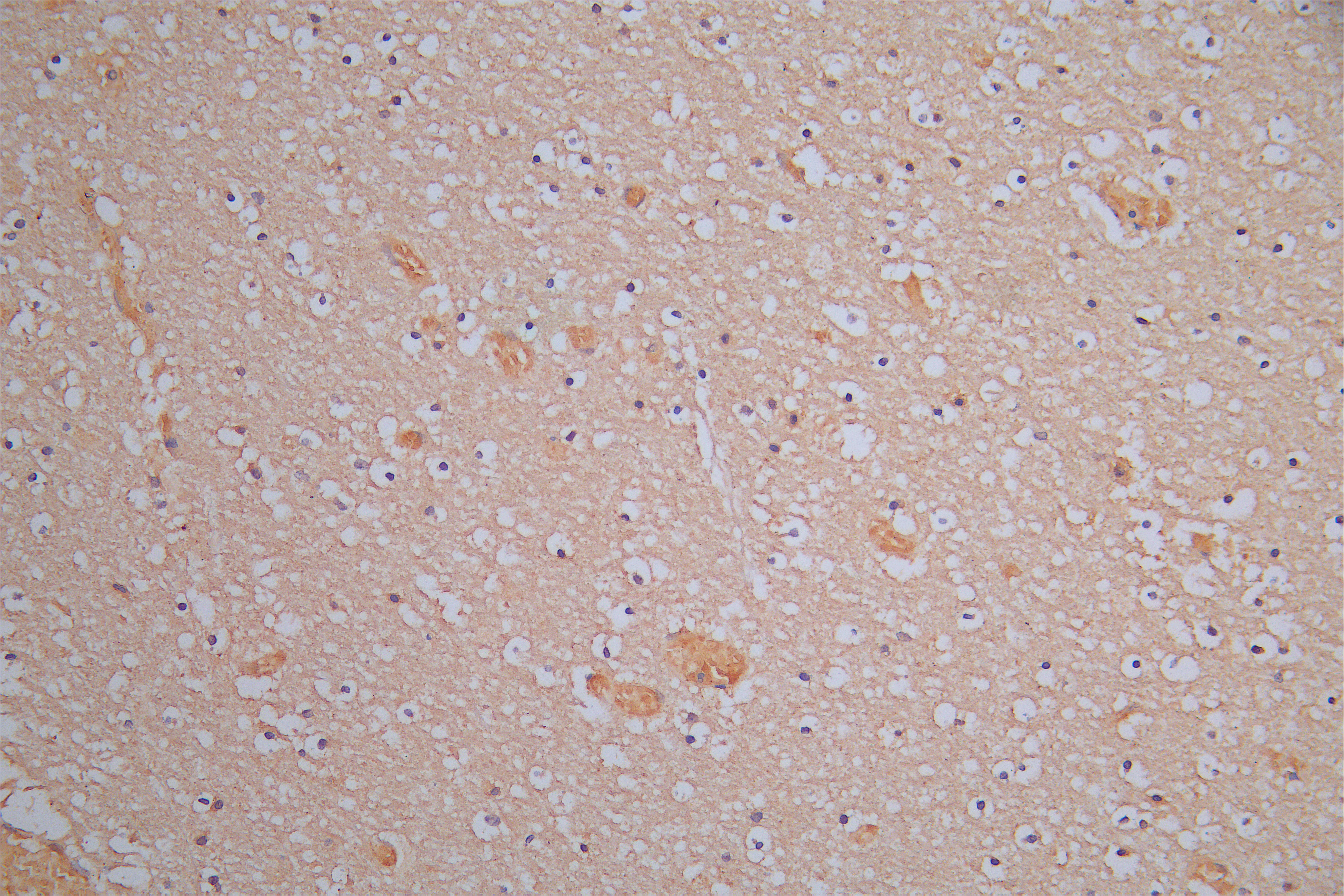 DPYSL2 Recombinant Monoclonal Antibody - image 1
