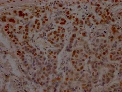 TP53 Recombinant Monoclonal Antibody - image 1