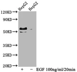 Phospho-MYC (T58+S62) Recombinant Monoclonal Antibody - image 1