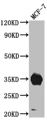 IGFBP2 Recombinant Monoclonal Antibody - image 1