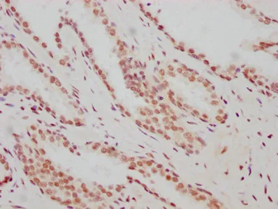 ARNT Recombinant Monoclonal Antibody - image 2
