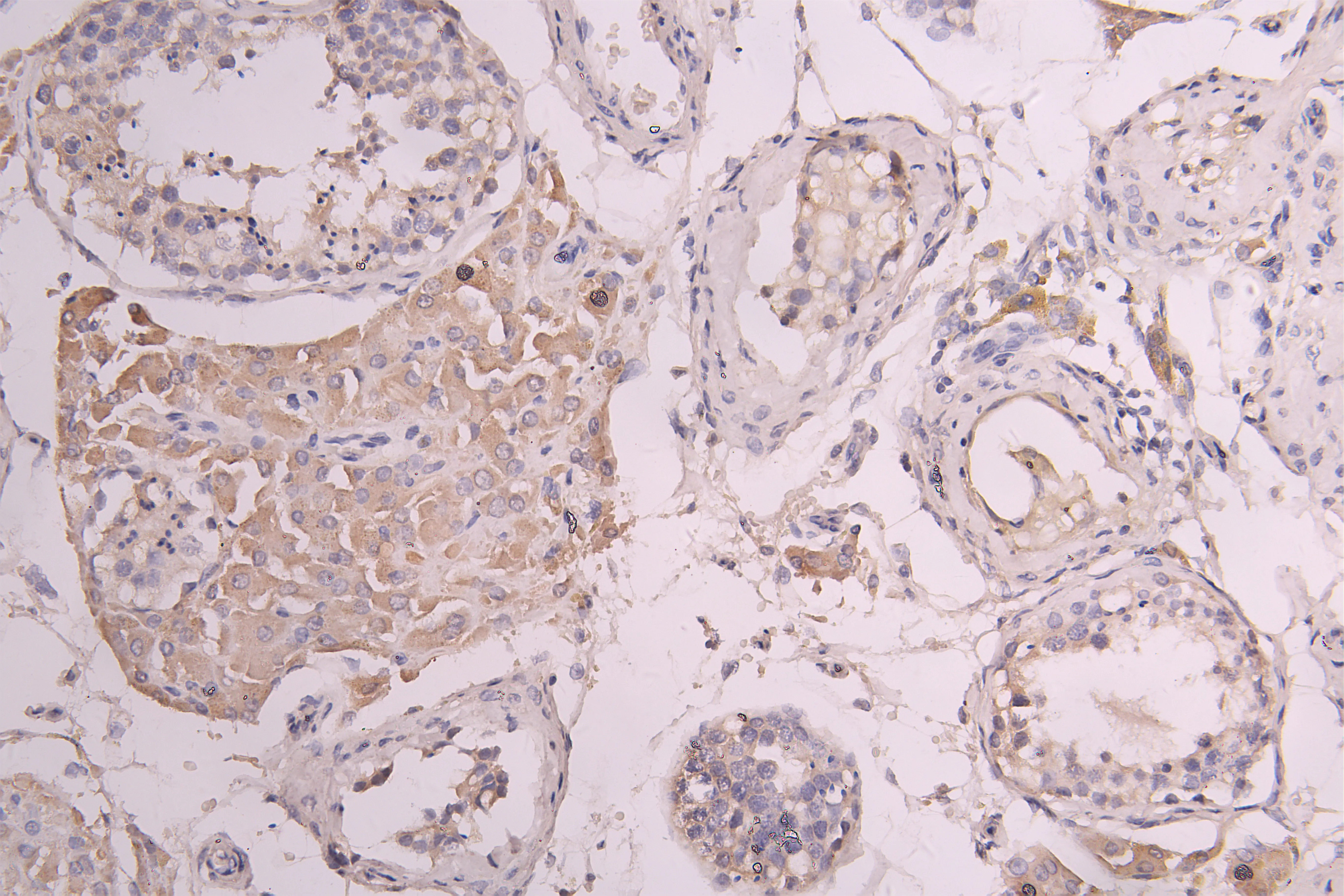 CSF3R Recombinant Monoclonal Antibody - image 1