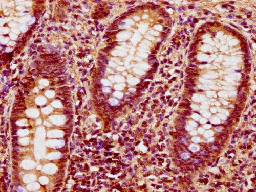 HIST1H1C (Ab-89) Antibody - image 1